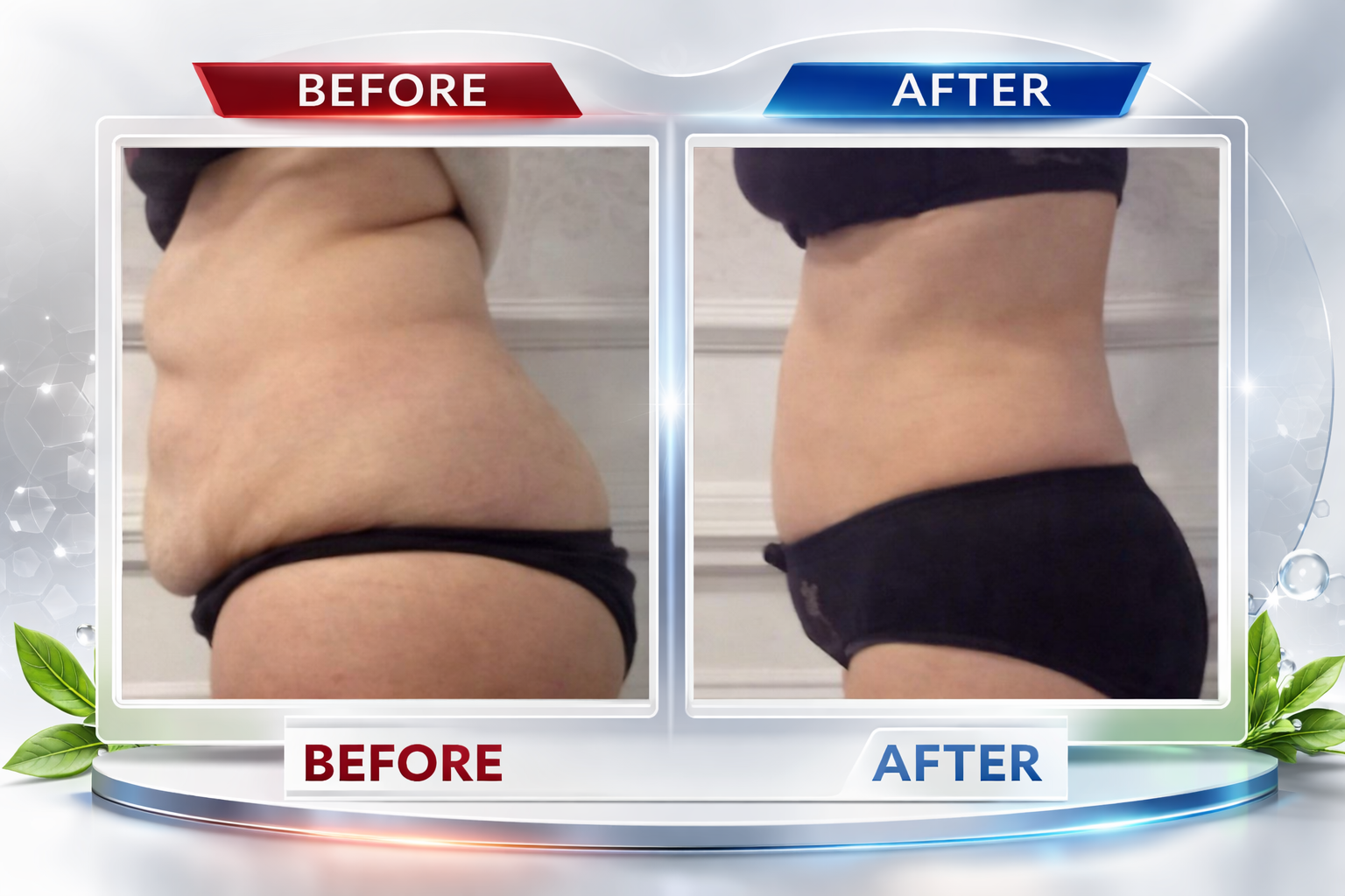 Photo of a woman who received NeurotriS facial microcurrent treatments for non-invasive lifting and toning.