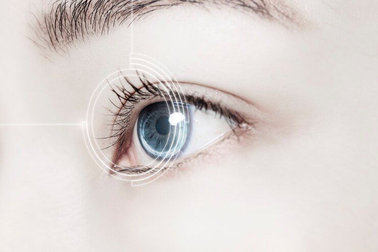 lasik