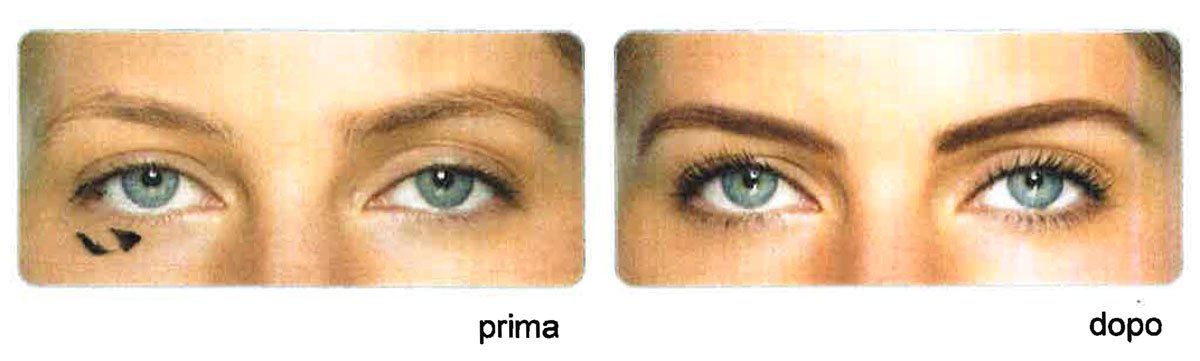 prima-dopo