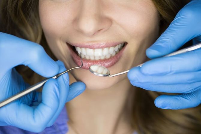 denti bianchi di una paziente