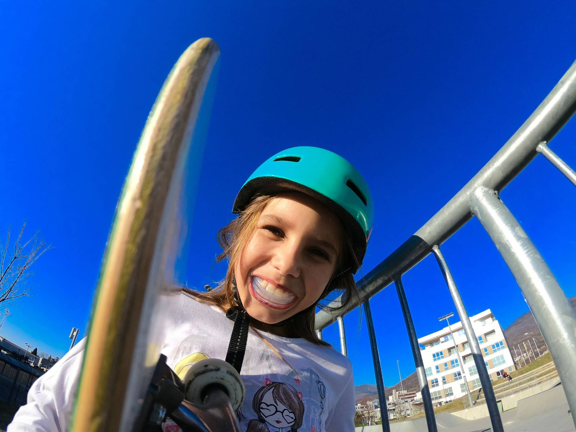 Little Skateboarder Using a Mouthguard | Hobart, TAS | Total Denture Care Clinics