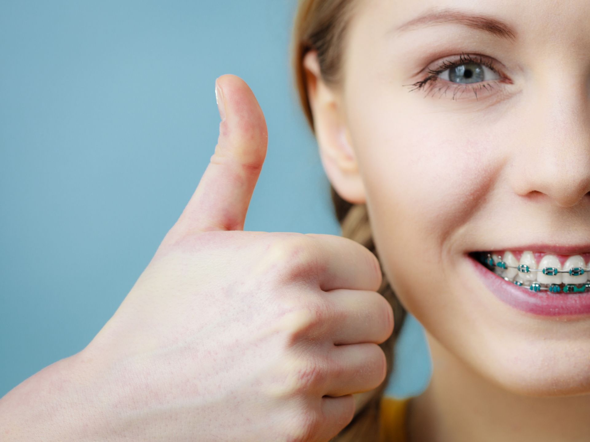 A woman with braces smiles and gives a thumbs up at Delgado Orthodontics in Bedford, TX, showcasing her satisfaction.