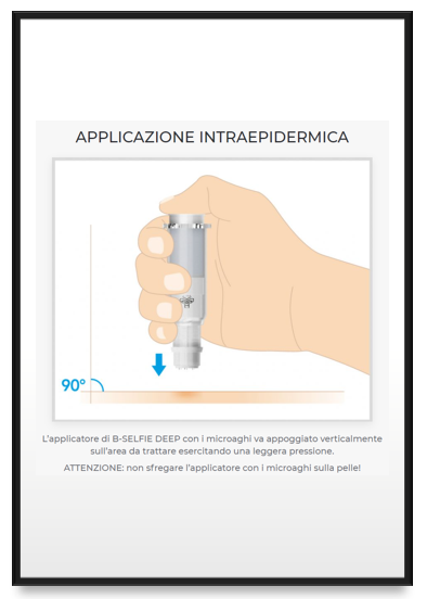 applicazione intraepidermica