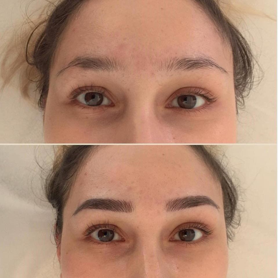Microblading