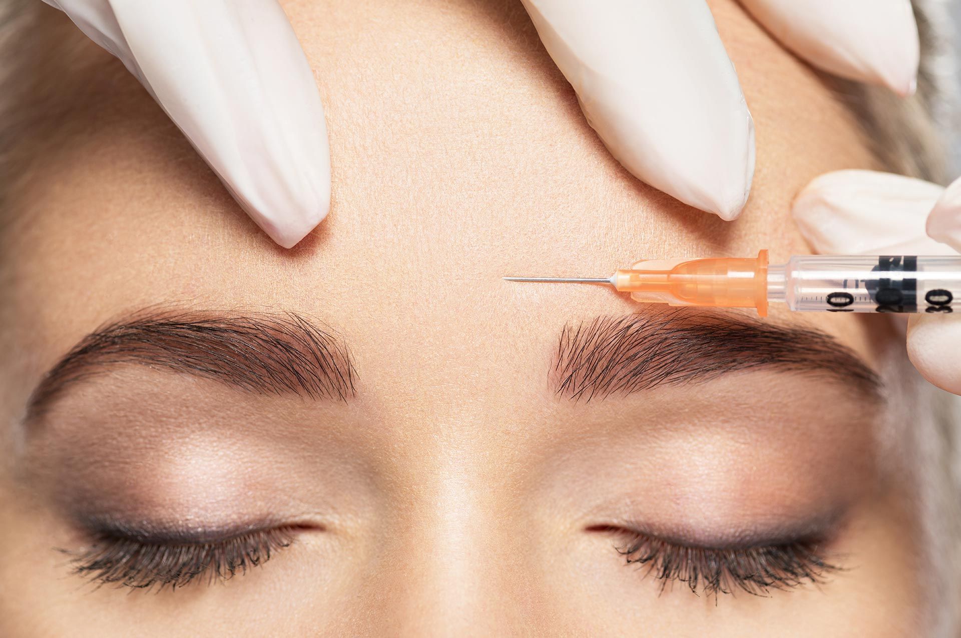 A woman is getting Botox in her forehead.