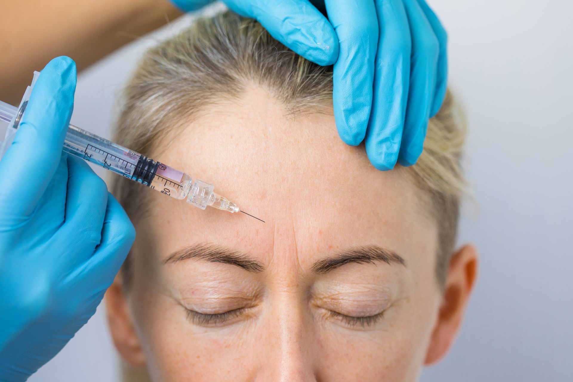 Gloved hands inject filler into a woman’s forehead in a medical spa setting Gloved hands inject filler into a woman’s forehead in a medical spa setting