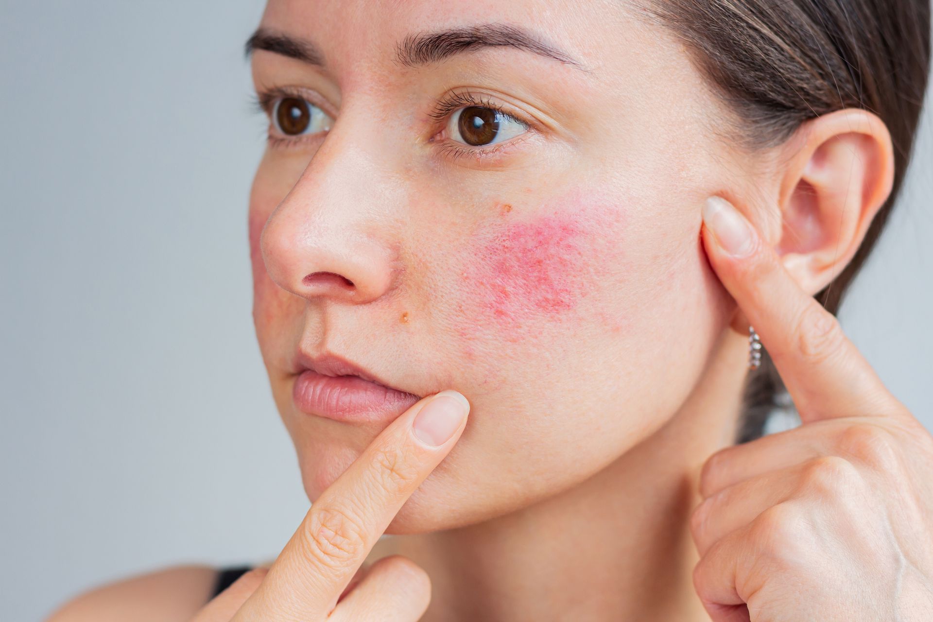 A person getting Botox Near Bayville, NJ