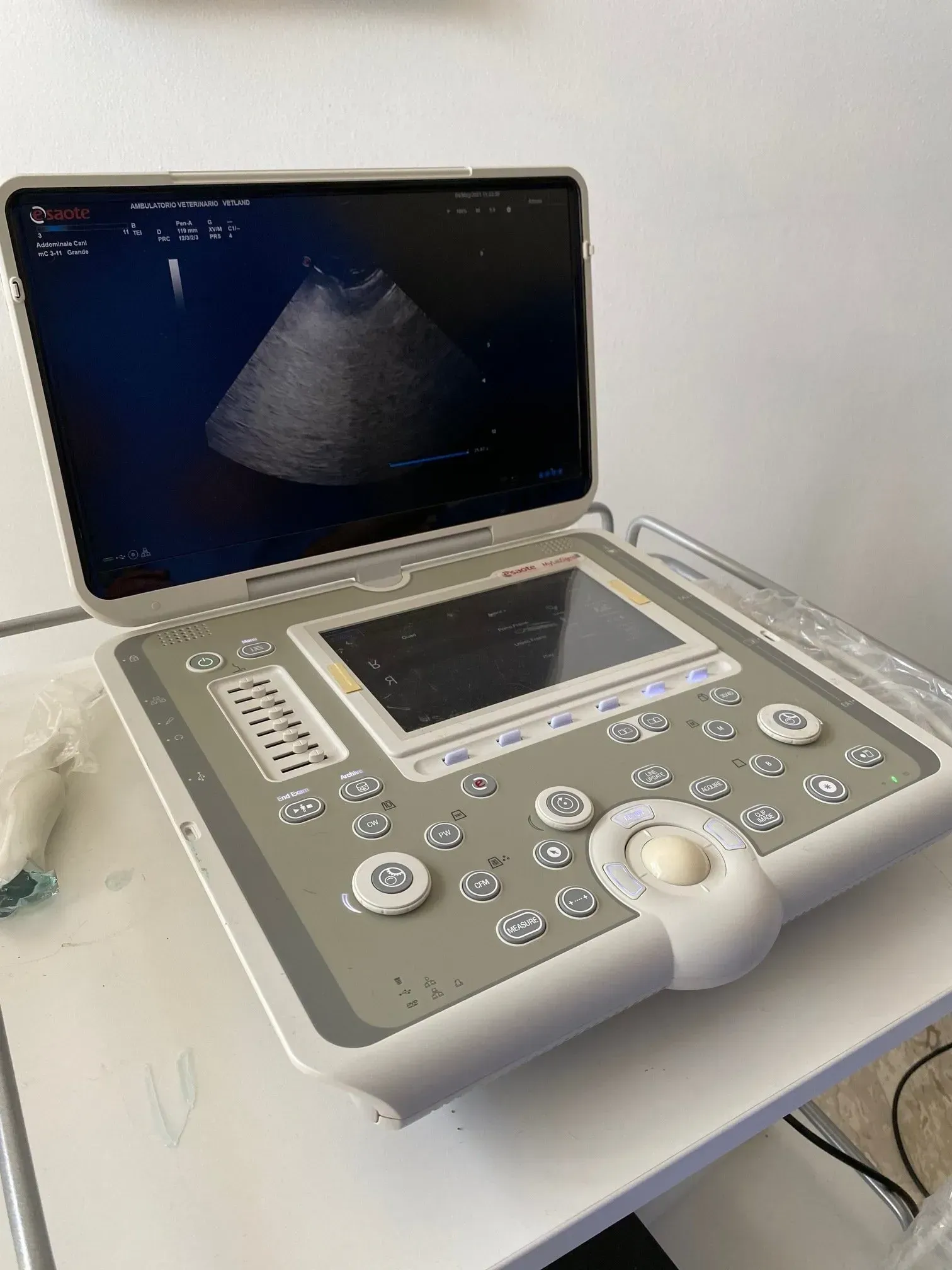 Un apparecchio ecografico portatile montato su un carrello, dotato di schermo per la visualizzazione della scansione diagnostica e di pannello di controllo.