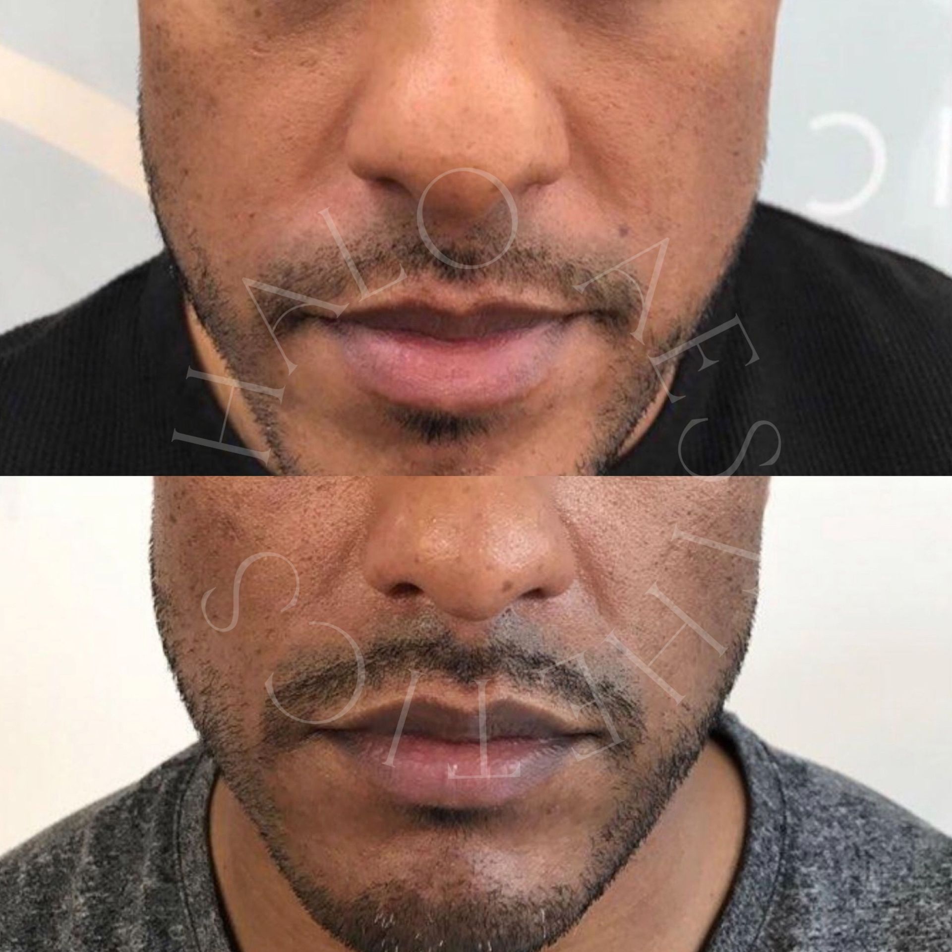 perfect peel milton keynes