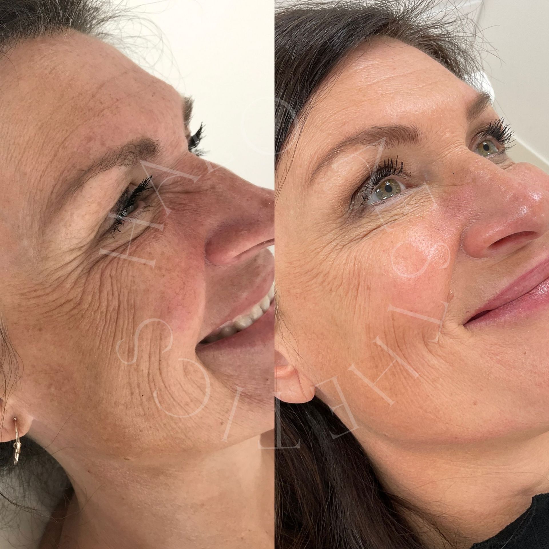 skincare milton keynes