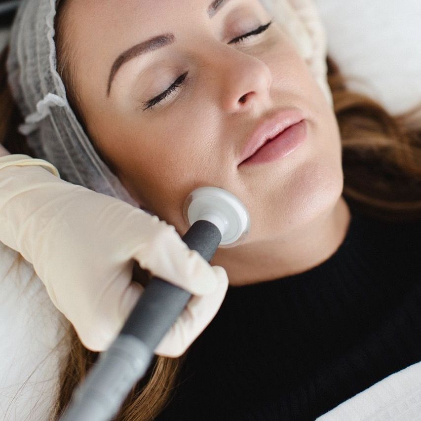 skin tightening milton keynes