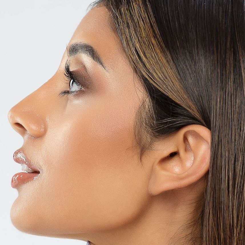 non surgical rhinoplasty milton keynes