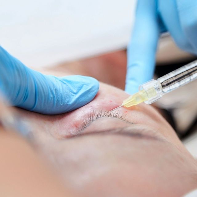 glutathione injection contraindication Reasons to Get a Glutathione Injection