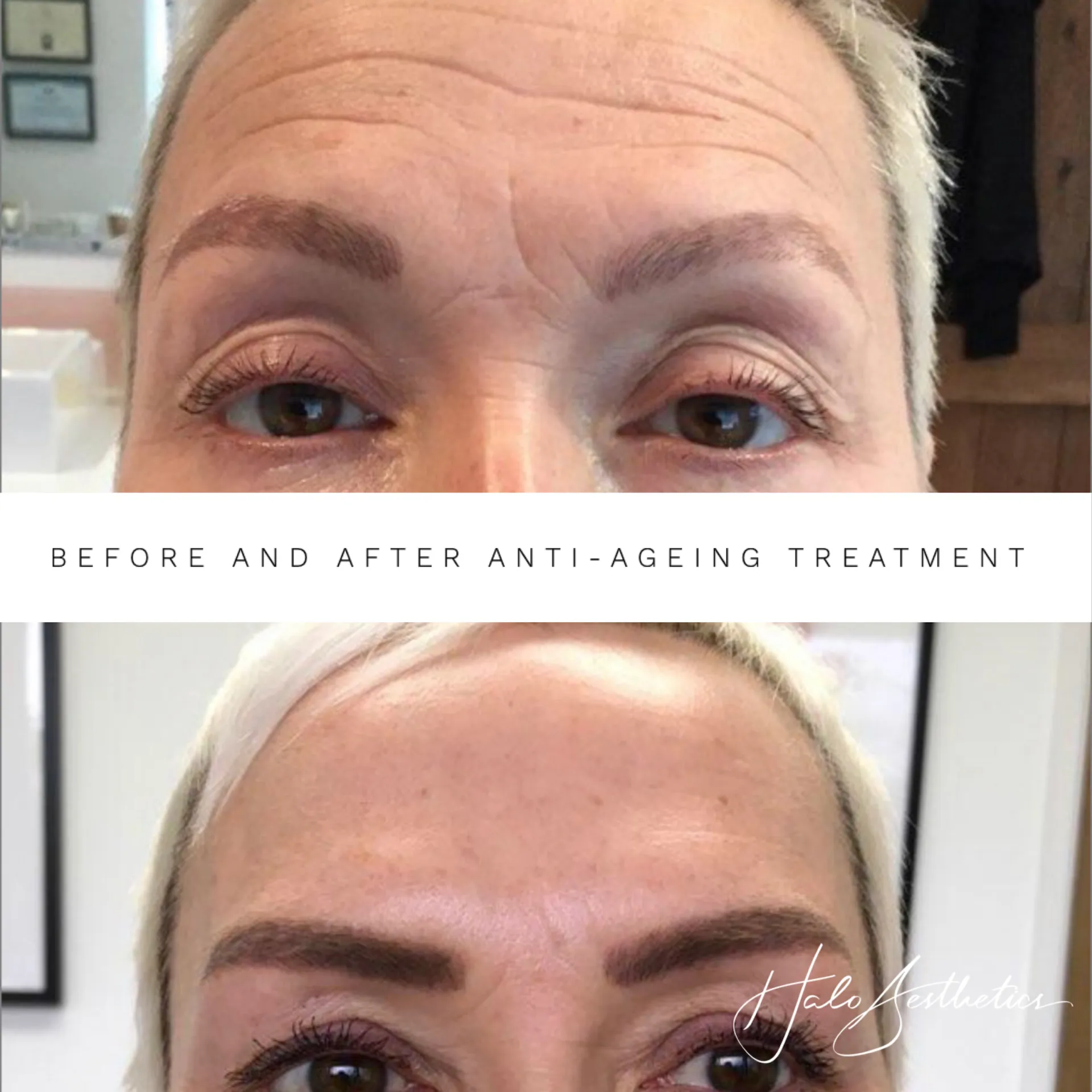 Aesthetics clinic photo guide Milton Keynes