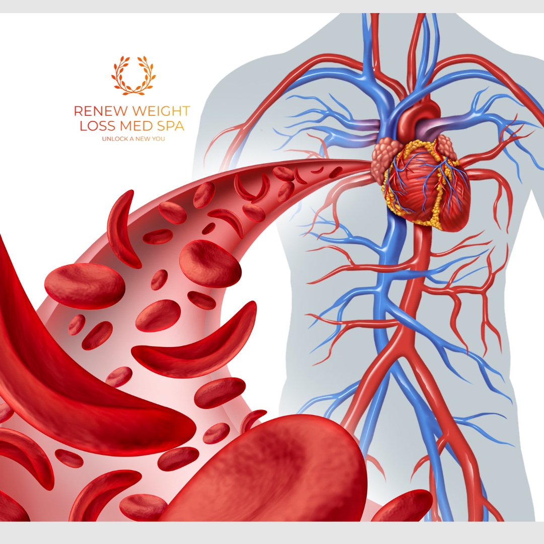 TRT causing high hematocrit, managing high red blood cells during testosterone replacement therapy, 