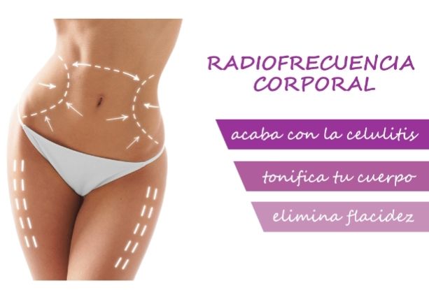 Radiofrecuencia