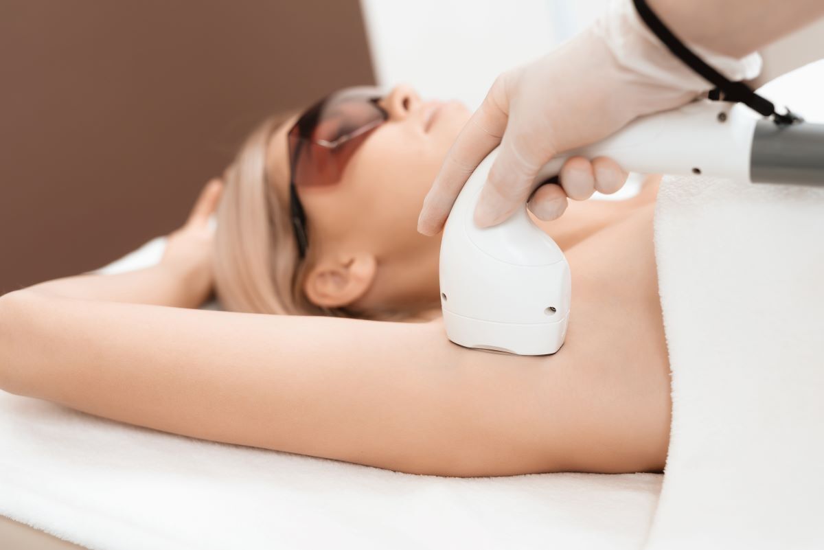 epilazione laser ascelle