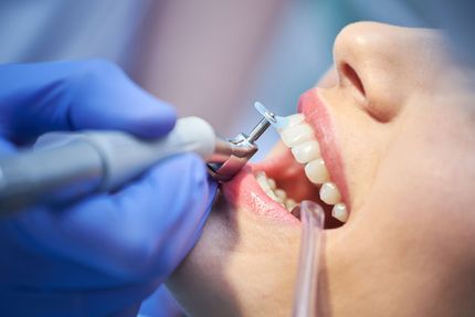 close medical dentist procedure teeth polishing