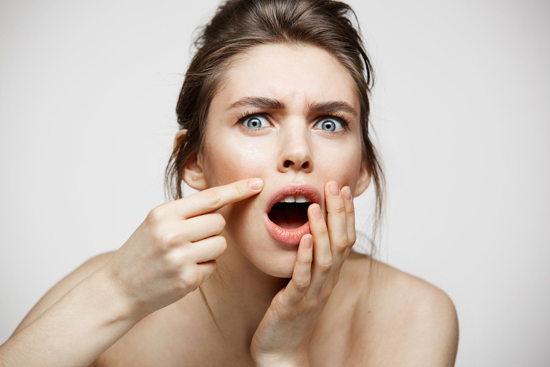 Una mujer señala un grano que tiene en la cara.