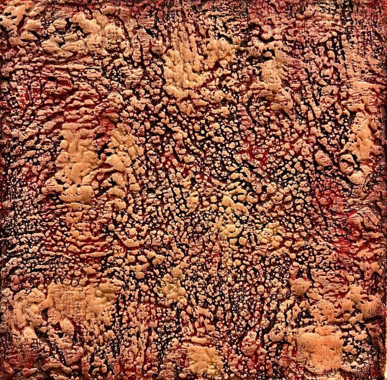 Tongue Papillae by Megan Wassom
