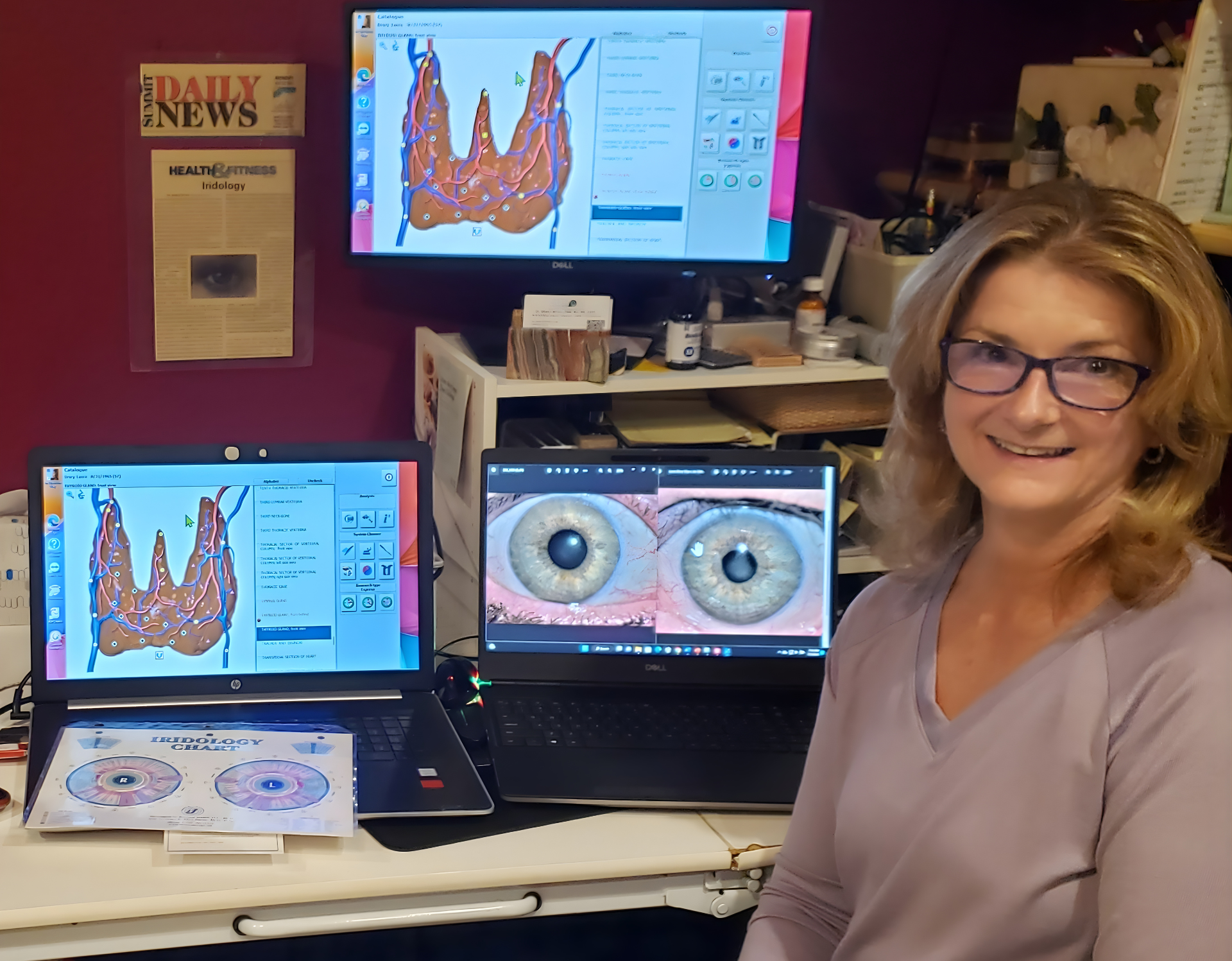 Woman with glasses smiles near laptops displaying medical scans. Purple wall, newspaper visible.