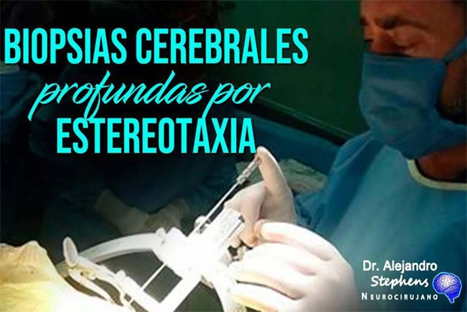 DR. ALEJANDRO STEPHENS - biopsias cerebrales