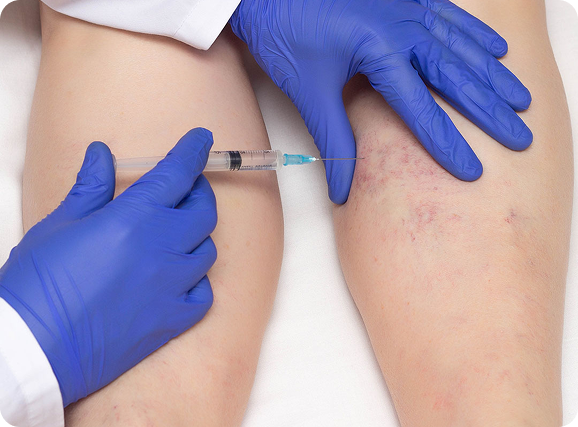 A person is getting an injection in their leg with a syringe.