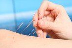 Herbs | Acupuncture Services in Clearwater, FL