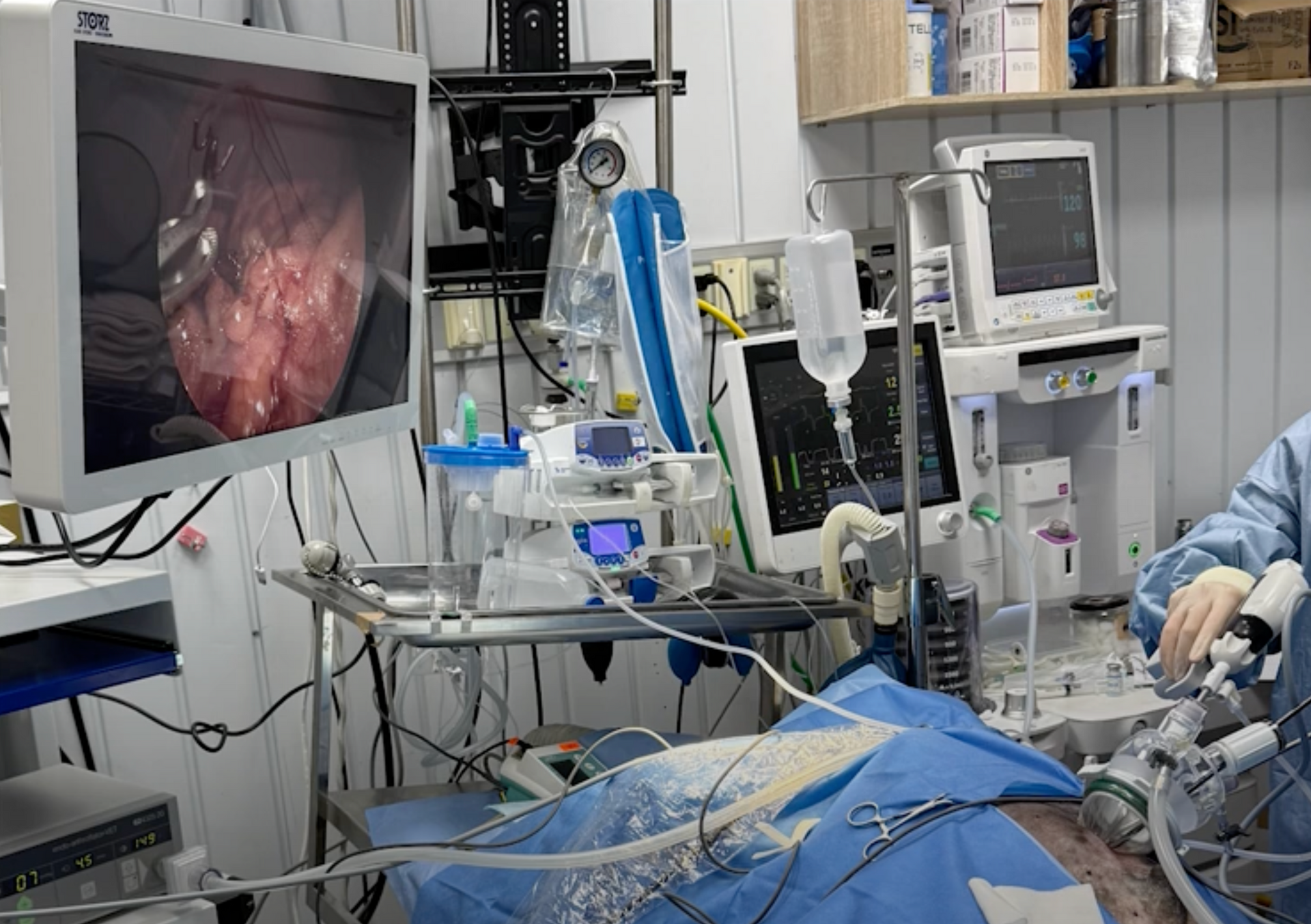 Laparoscopic Universal Smoke Evacuator hoe it work