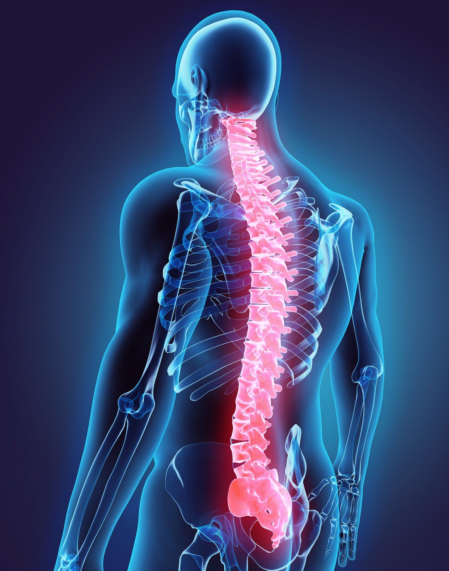 Backpain Illustration | Albany, NY | Capital District Interventional Spine & Rehabilitation PLLC