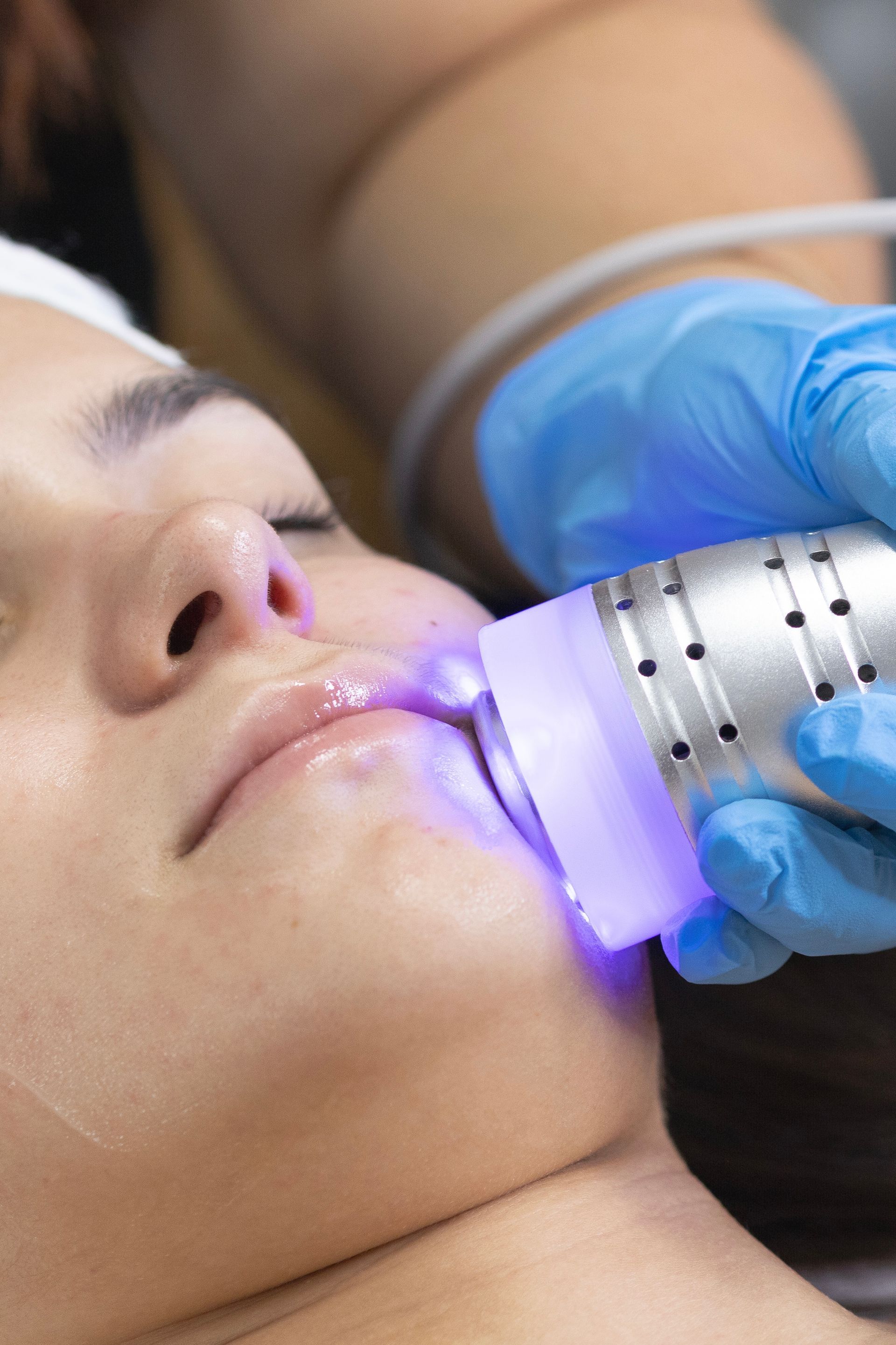 A woman is getting a laser treatment on her face.