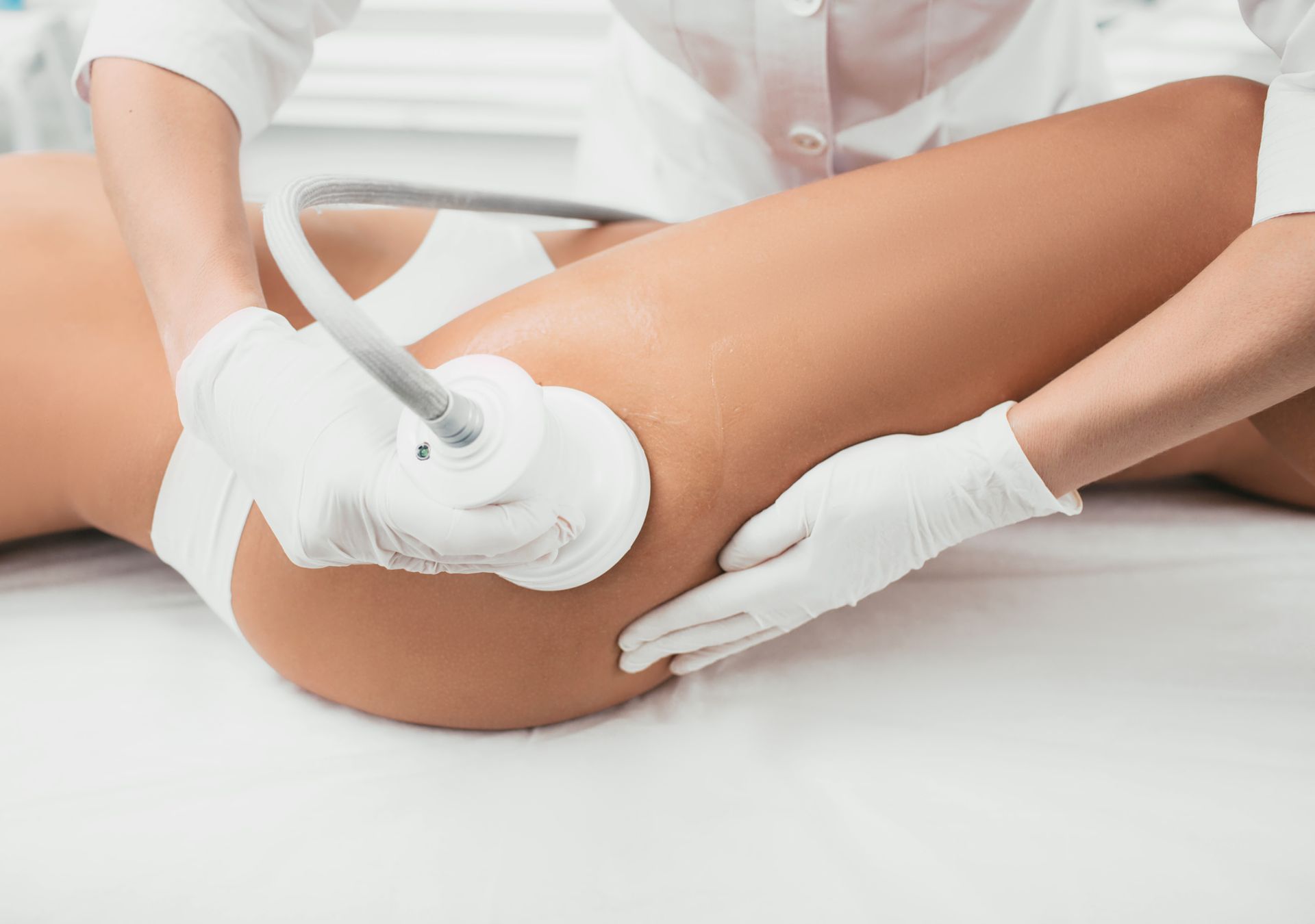 a woman getting cellulite reduction treatment