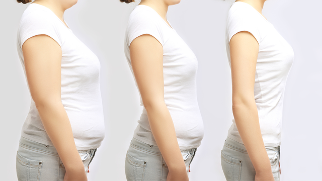 Medical Weight Loss | Longwood, FL | 321-316-4831