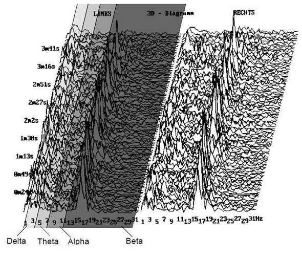 EEG landscape diagram of NATHAL session