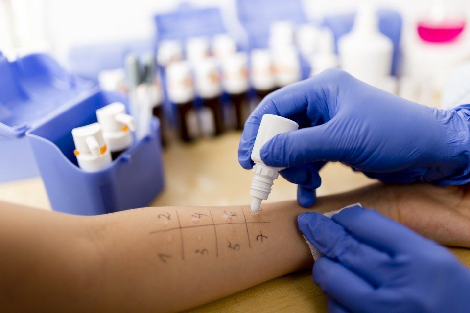 dermatological allergy testing