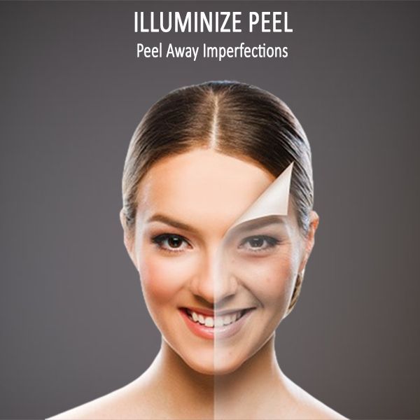 illuminize peel