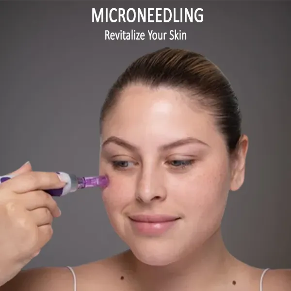 microneedling near me