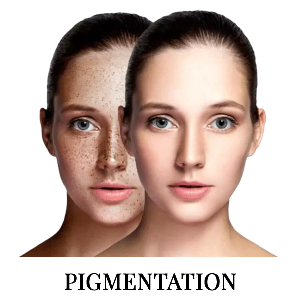 Two women faces side by side one with pigmented skin and other with clear   and the word pigmentation under it