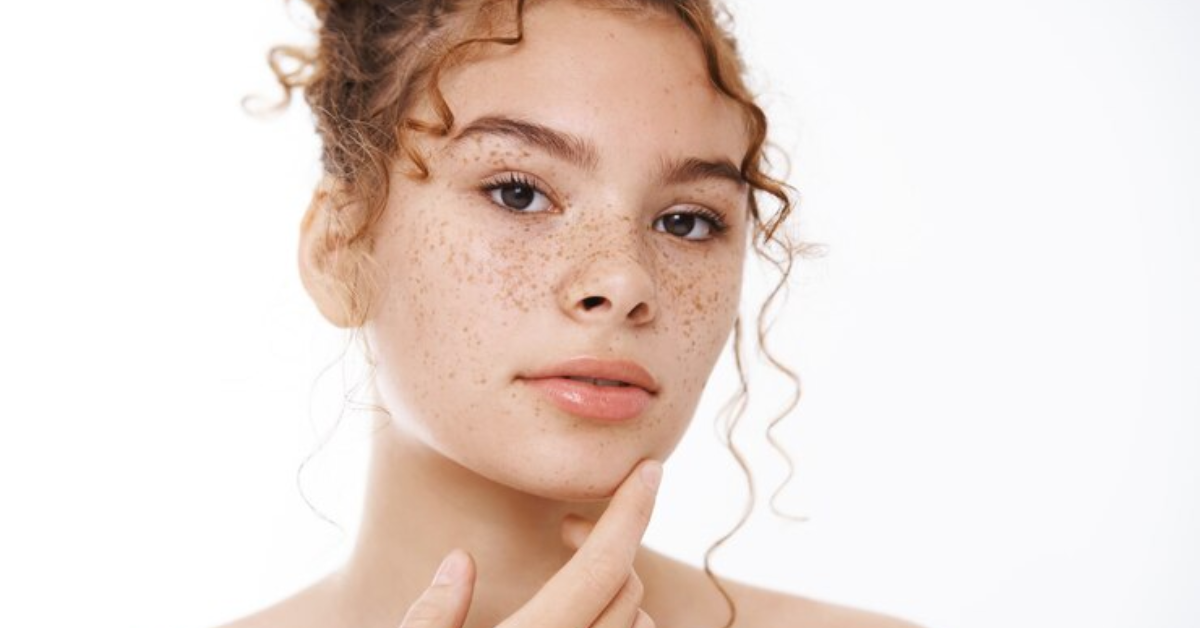 What Are the Treatment Options for Skin Pigmentation?