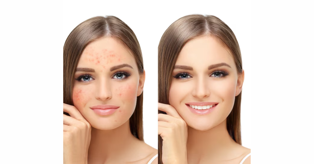 How Is Skin Pigmentation Diagnosed?