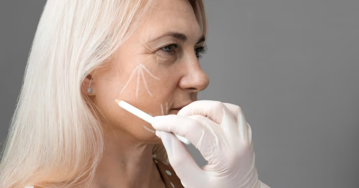 Can Laser Treatment Really Get Rid of Wrinkles?