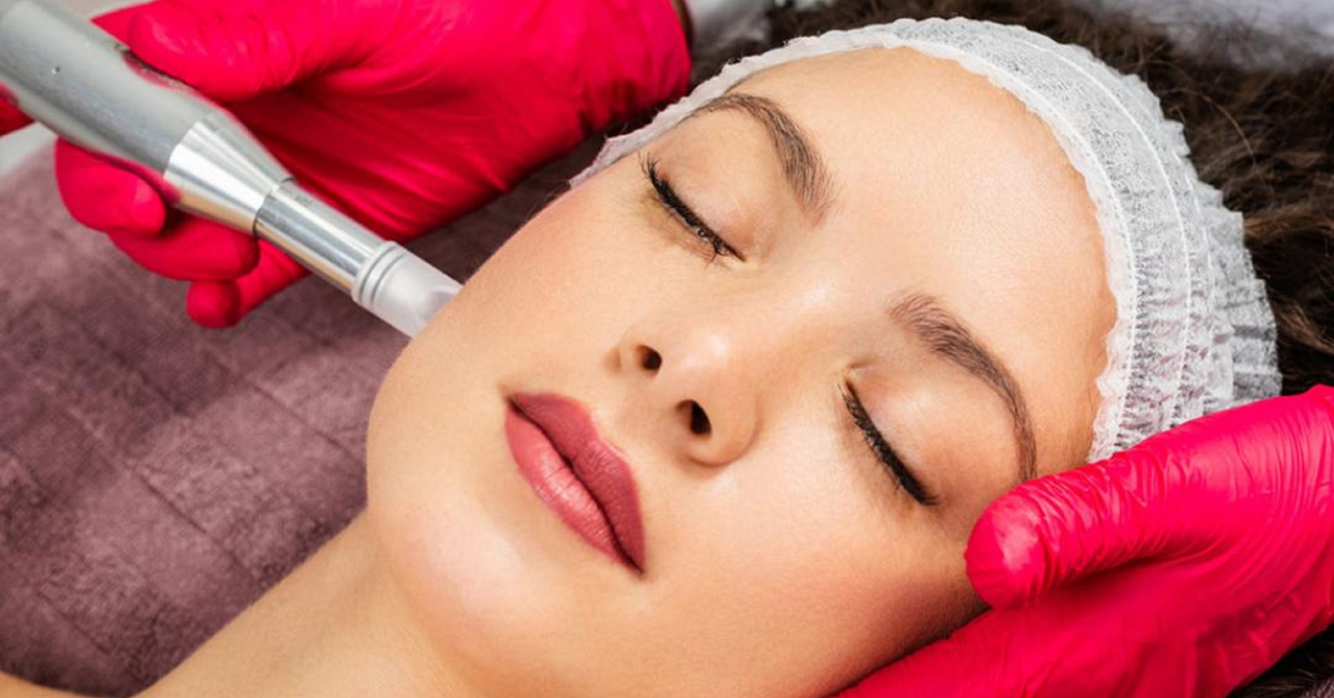 Does Microneedling Tighten Skin?