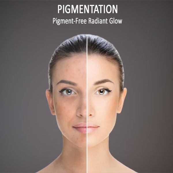 skin pigmentation