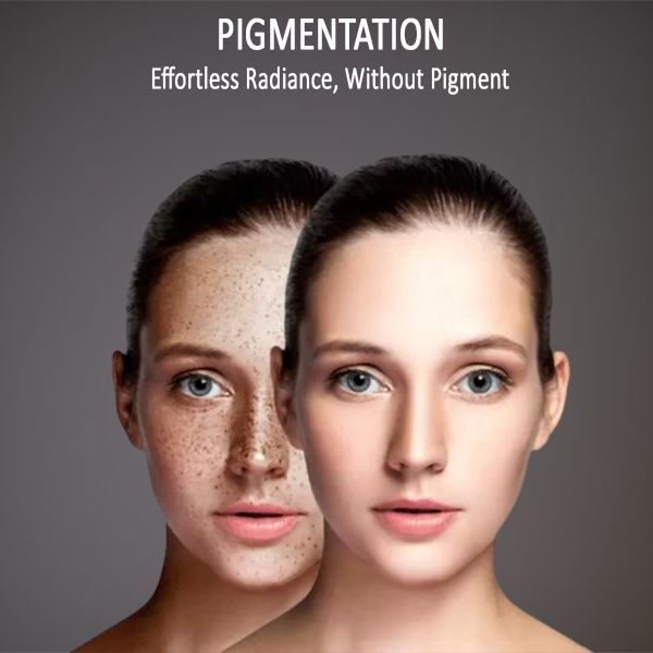 skin pigmentation 