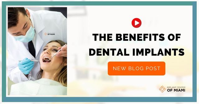 The benefits of dental implants