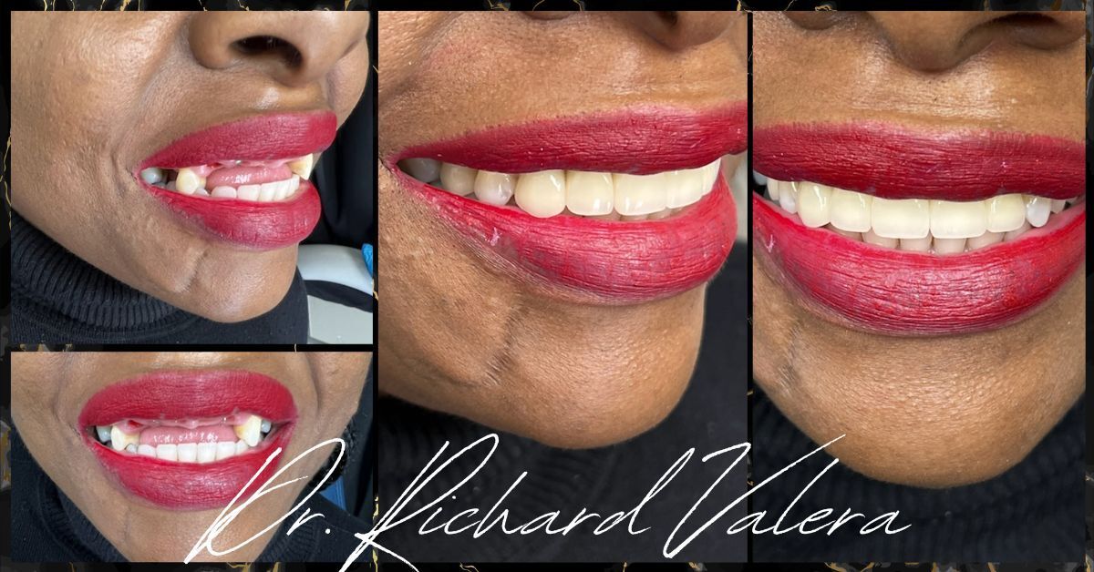 dr richard valera before and after 3