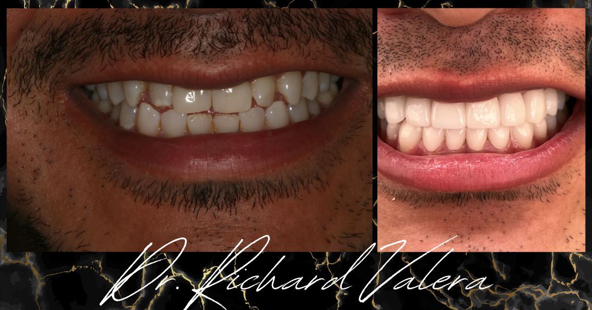 dr richard valera before and after 1
