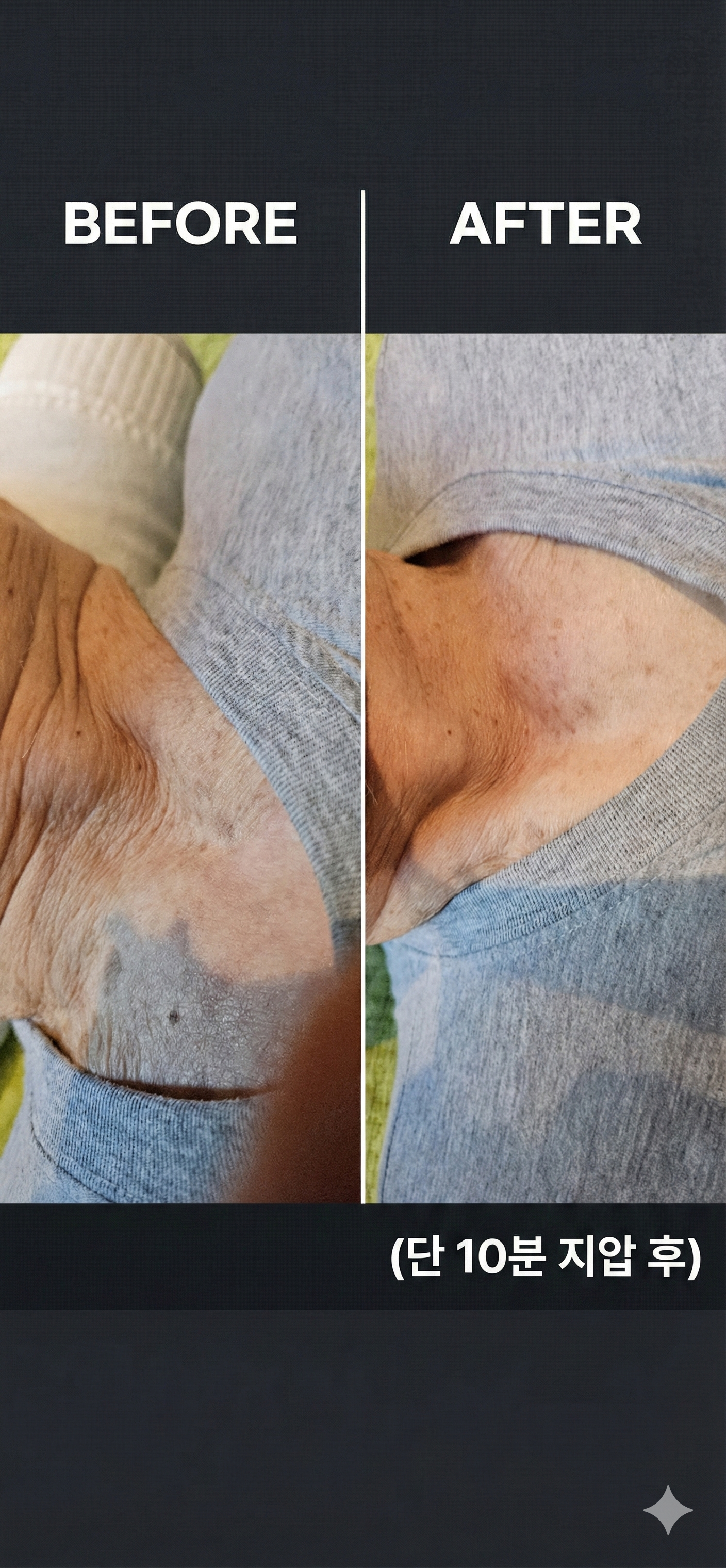 Before and after photo of natural wrinkle improvement massage at Jeongyeon Foot Massage Gangnam