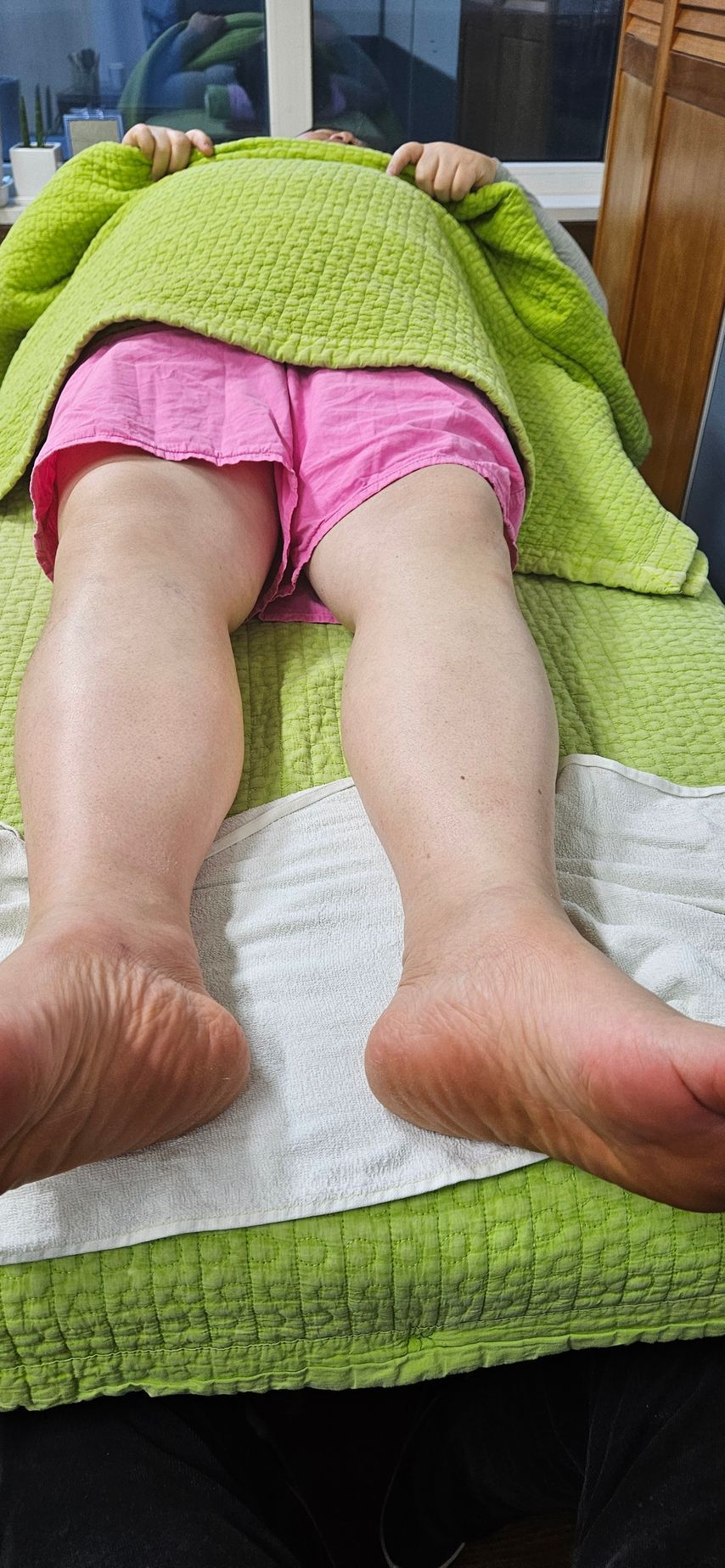 picture of the customer's healthy feet which is treated by 29 year Gangnam Jeongyeon Footmassage