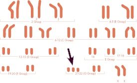 A diagram of a person 's chromosomes with an arrow pointing to the right.